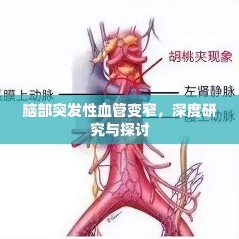 脑部突发性血管变窄，深度研究与探讨