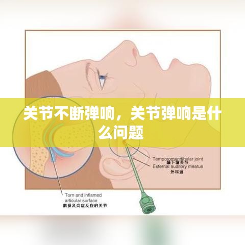 关节不断弹响，关节弹响是什么问题 